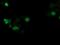 SSX Family Member 1 antibody, NBP2-00614, Novus Biologicals, Immunofluorescence image 