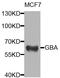 Glucosylceramidase Beta antibody, orb374111, Biorbyt, Western Blot image 