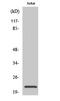 Cancer-related nucleoside-triphosphatase antibody, A13743-2, Boster Biological Technology, Western Blot image 