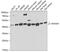 Dihydroorotate Dehydrogenase (Quinone) antibody, 22-539, ProSci, Western Blot image 