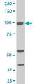 10-FTHFDH antibody, LS-B5449, Lifespan Biosciences, Western Blot image 