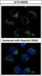 Carnitine O-Acetyltransferase antibody, GTX103000, GeneTex, Immunocytochemistry image 