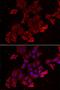 ATPase H+ Transporting V1 Subunit B1 antibody, orb247646, Biorbyt, Immunocytochemistry image 