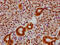 SMAD Family Member 5 antibody, CSB-RA859108A463phHU, Cusabio, Immunohistochemistry paraffin image 