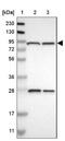 Mannosyl-oligosaccharide glucosidase antibody, NBP1-81839, Novus Biologicals, Western Blot image 