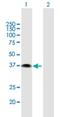 ETV7 antibody, H00051513-B01P, Novus Biologicals, Western Blot image 
