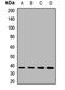 Dimethylarginine Dimethylaminohydrolase 1 antibody, LS-C668720, Lifespan Biosciences, Western Blot image 