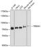 E3 ubiquitin-protein ligase TRIM41 antibody, GTX66427, GeneTex, Western Blot image 