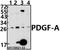 Platelet Derived Growth Factor Subunit A antibody, GTX66716, GeneTex, Western Blot image 