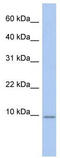 FXYD Domain Containing Ion Transport Regulator 7 antibody, TA338705, Origene, Western Blot image 