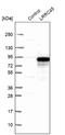 Leucine Rich Repeat Containing 45 antibody, NBP1-93508, Novus Biologicals, Western Blot image 