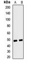 Ferrochelatase, mitochondrial antibody, orb412716, Biorbyt, Western Blot image 