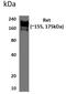 Ret Proto-Oncogene antibody, GTX53139, GeneTex, Western Blot image 