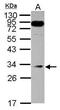 Mediator Complex Subunit 8 antibody, PA5-28907, Invitrogen Antibodies, Western Blot image 