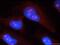 Ribosomal Protein S6 Kinase A3 antibody, 23762-1-AP, Proteintech Group, Immunofluorescence image 