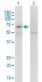 Potassium Voltage-Gated Channel Subfamily Q Member 5 antibody, H00056479-M01, Novus Biologicals, Western Blot image 