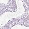 Family With Sequence Similarity 81 Member B antibody, NBP2-49677, Novus Biologicals, Immunohistochemistry paraffin image 