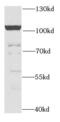 Cell division cycle 5-like protein antibody, FNab01535, FineTest, Western Blot image 