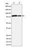 Methylmalonyl-CoA Mutase antibody, M34008-1, Boster Biological Technology, Western Blot image 
