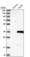 N-Acetyltransferase 9 (Putative) antibody, PA5-54521, Invitrogen Antibodies, Western Blot image 