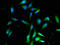 Aldehyde Dehydrogenase 9 Family Member A1 antibody, LS-C498365, Lifespan Biosciences, Immunofluorescence image 