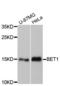 Bet1 Golgi Vesicular Membrane Trafficking Protein antibody, A13069, ABclonal Technology, Western Blot image 