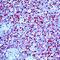 Myogenin antibody, MA5-11486, Invitrogen Antibodies, Immunohistochemistry paraffin image 