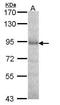 Dipeptidyl Peptidase 8 antibody, TA308446, Origene, Western Blot image 