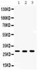 Carbonic anhydrase C antibody, PB9989, Boster Biological Technology, Western Blot image 