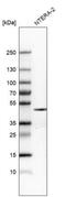 Nanog Homeobox antibody, NBP2-61429, Novus Biologicals, Western Blot image 