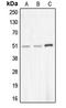 Cholinergic Receptor Nicotinic Alpha 10 Subunit antibody, LS-C353498, Lifespan Biosciences, Western Blot image 