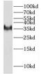 Hydroxysteroid 17-Beta Dehydrogenase 7 antibody, FNab04028, FineTest, Western Blot image 