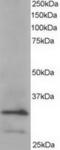 Actin Related Protein 2/3 Complex Subunit 2 antibody, TA302794, Origene, Western Blot image 
