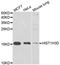 Histone H3 antibody, A7010, ABclonal Technology, Western Blot image 