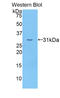Complement C3b/C4b Receptor 1 (Knops Blood Group) antibody, LS-C293503, Lifespan Biosciences, Western Blot image 