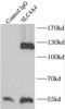SLC4A4 antibody, FNab07967, FineTest, Immunoprecipitation image 