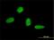 C22 antibody, H00121340-M01, Novus Biologicals, Immunofluorescence image 
