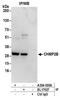 Charged Multivesicular Body Protein 2B antibody, A304-500A, Bethyl Labs, Immunoprecipitation image 
