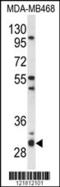 Proteasome Assembly Chaperone 2 antibody, 64-068, ProSci, Western Blot image 
