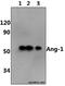 Angiopoietin 1 antibody, GTX66700, GeneTex, Western Blot image 