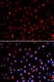 DNA excision repair protein ERCC-1 antibody, LS-C333960, Lifespan Biosciences, Immunofluorescence image 