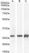 Paired Box 6 antibody, NB100-61654, Novus Biologicals, Western Blot image 