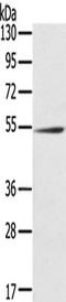 Regulator Of Microtubule Dynamics 3 antibody, TA350307, Origene, Western Blot image 
