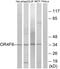 Olfactory Receptor Family 4 Subfamily F Member 6 antibody, GTX87747, GeneTex, Western Blot image 