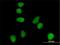 ATR Serine/Threonine Kinase antibody, H00000545-M01, Novus Biologicals, Immunocytochemistry image 