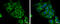 Lactate Dehydrogenase C antibody, GTX114525, GeneTex, Immunocytochemistry image 