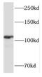 Forkhead Box M1 antibody, FNab03200, FineTest, Western Blot image 