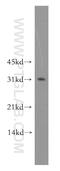 Phenylethanolamine N-Methyltransferase antibody, 13217-1-AP, Proteintech Group, Western Blot image 