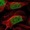 Zinc Finger Protein 532 antibody, NBP1-83838, Novus Biologicals, Immunofluorescence image 