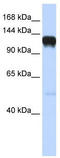 EPH Receptor A5 antibody, TA344332, Origene, Western Blot image 